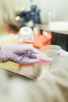 How do doctors test for allergies?