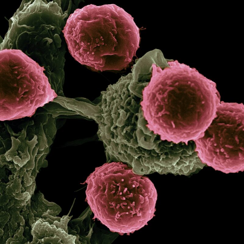 Are there different types of cancer?