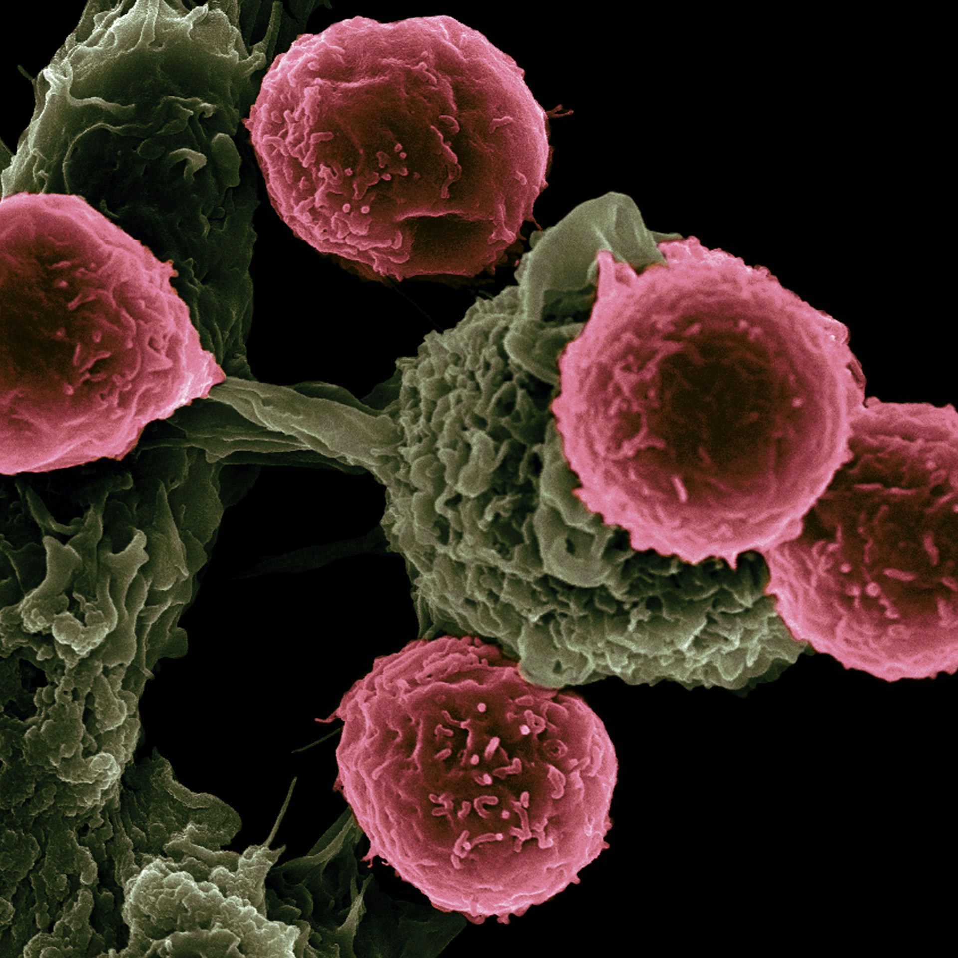 Are there different types of cancer?
