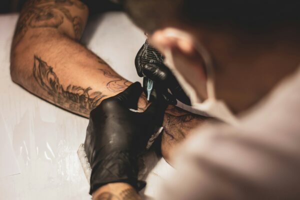 Can a tattoo be removed?