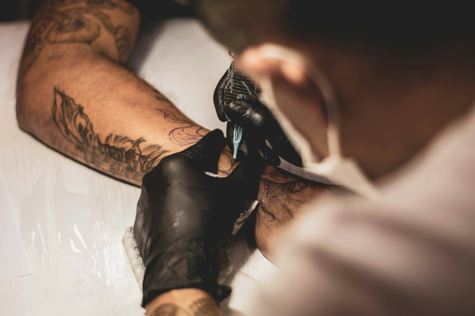 Can a tattoo be removed?