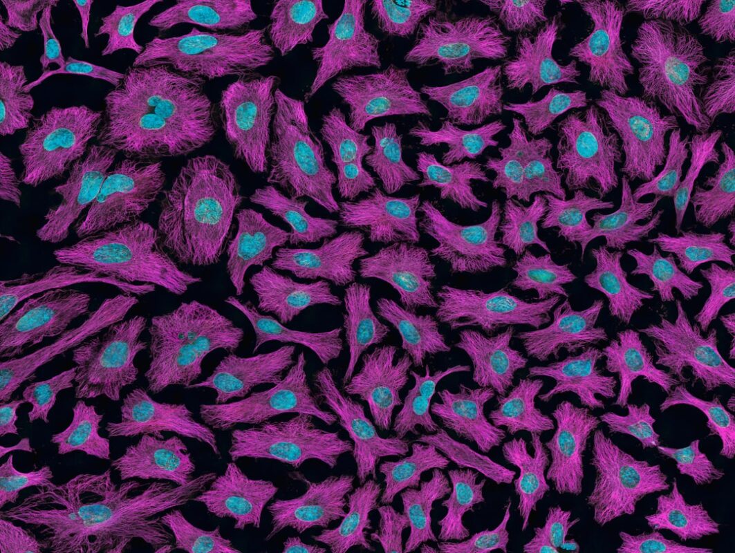 What causes cancer?