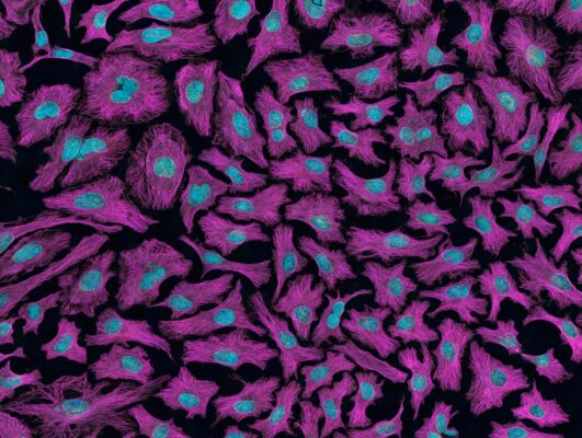 What causes cancer?