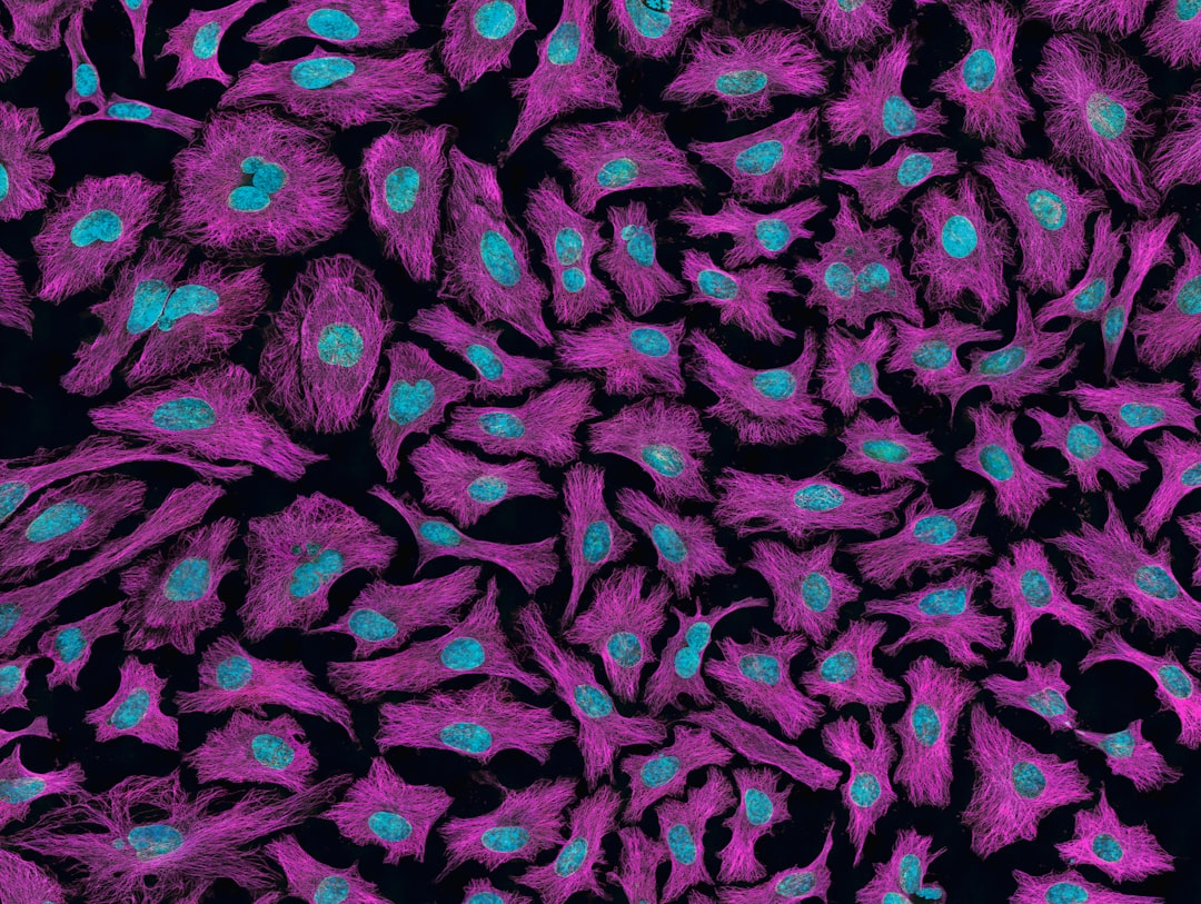 What causes cancer?